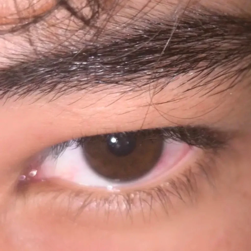 Profil