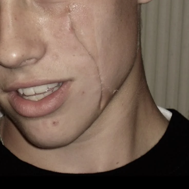 Profil