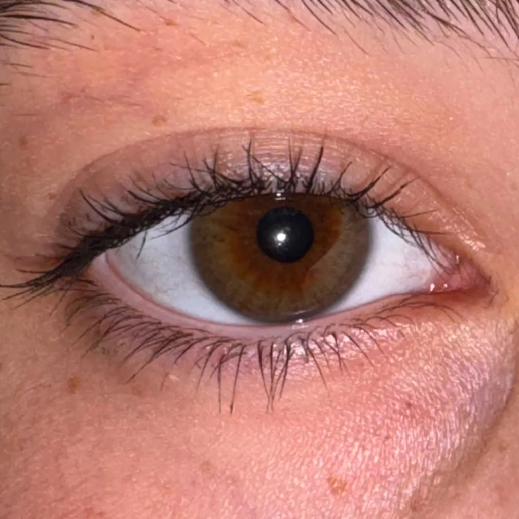 Profil